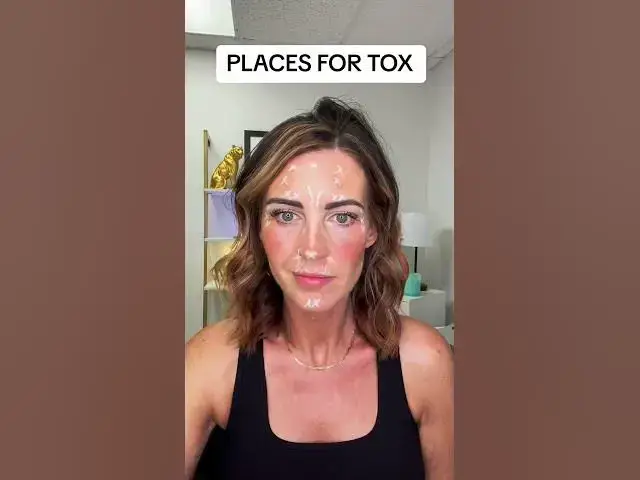 'Video thumbnail for Some of the many places to have tox to help prevent and reduce fine lines and wrinkles!'