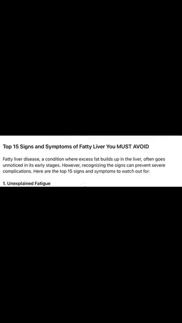 Video thumbnail for Top 15 Signs and Symptoms of Fatty Liver You MUST AVOID