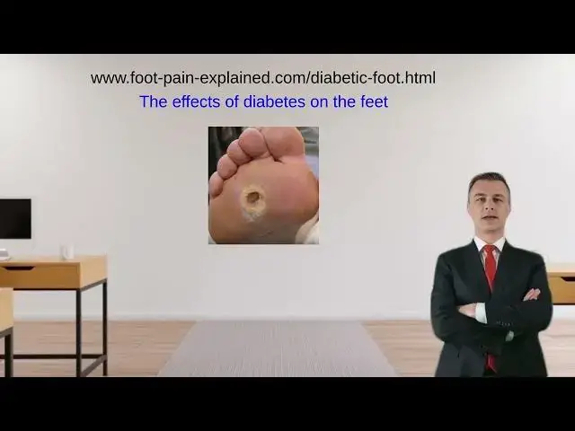 'Video thumbnail for Diabetes and the foot'