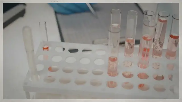 Video thumbnail for Hemokare BBL Gummies Reviews: Does It Really Work?