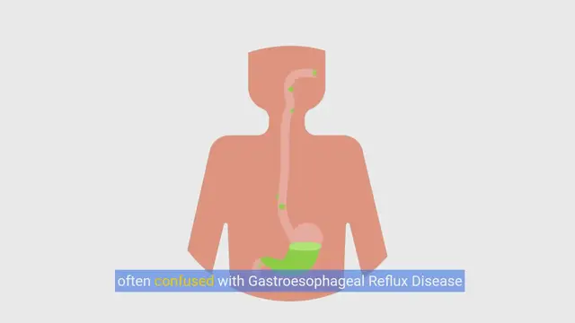 Video thumbnail for Understanding Acid Reflux: Causes, Prevention, and Lifestyle Tips