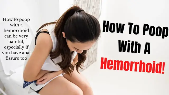 'Video thumbnail for How To Poop With a Hemorrhoid'