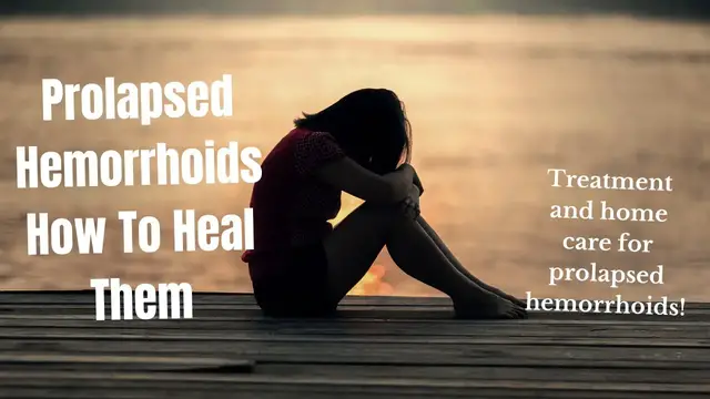 'Video thumbnail for Prolapsed Hemorrhoids | How To Heal Them'