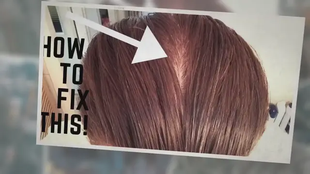 'Video thumbnail for Why has my hair started parting in the back?'