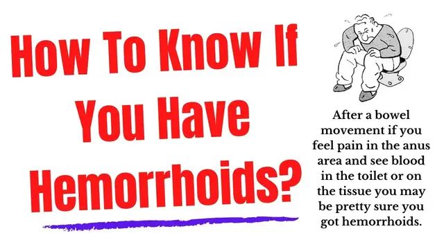 'Video thumbnail for How To Know If You Have Hemorrhoids'