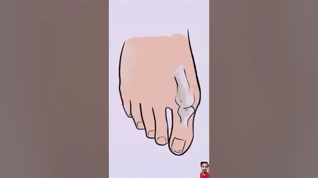 Video thumbnail for Footcare Product for Toe Deformities | 🔗 Link is in Description | #trending #beauty #gadgets