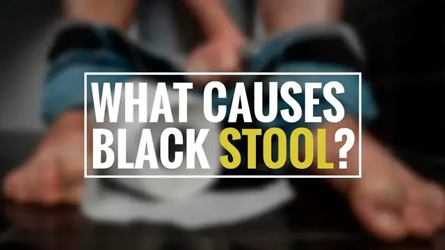 Video thumbnail for Black Stool: Causes, Symptoms, Diagnosis & Treatment | Health Solution