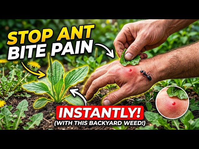 Video thumbnail for Stop Ant Bite Pain INSTANTLY with this Backyard Weed! Home Remedies to Ease Pain of Fire Ant Stings