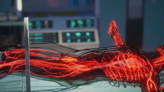 Video thumbnail for Understanding Stroke Risk Factors