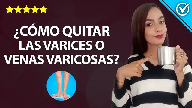 Video thumbnail for Cómo Quitar o Eliminar las Varices o Venas Varicosas ¿Qué es Escleroterapia? Tratamientos Varices 🦵