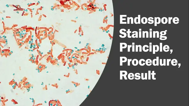 'Video thumbnail for Endospore Staining by Schaeffer Fulton Method and Dorner’s Method'