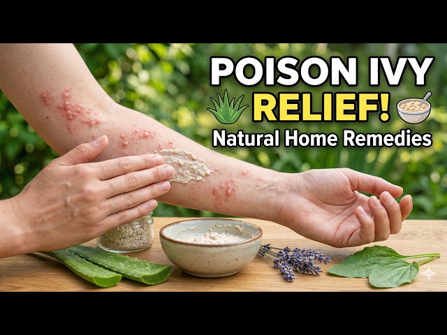 Video thumbnail for Natural Home Remedies for Poison Ivy Relief #homeremedies #herbalremedies #diyskincare
