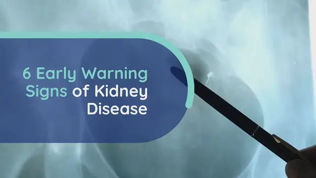 Video thumbnail for 6 Early Warning Signs of Kidney Disease