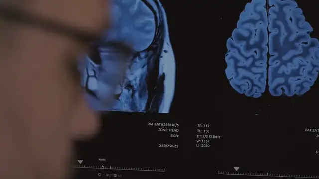 Video thumbnail for AI in Healthcare: Revolutionizing Diagnosis, Treatment, and Patient Care