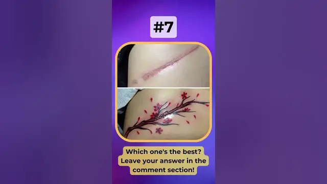'Video thumbnail for Top 10 Creative Scar Cover Up Tattoo Art: You Can Only Choose One | #Shorts'
