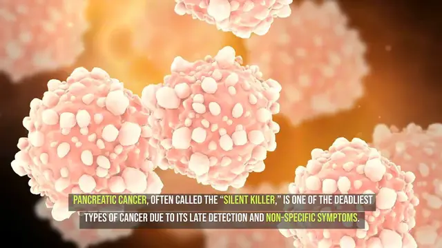 Video thumbnail for Early Signs of Pancreatic Cancer