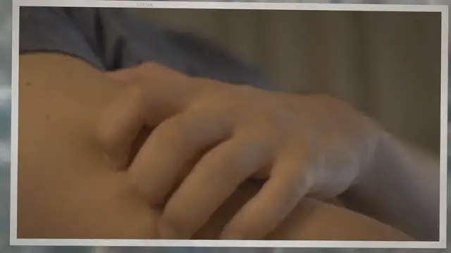 'Video thumbnail for Different types of lipitor rash'
