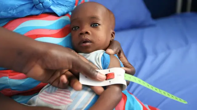 'Video thumbnail for Malnutrition crisis worsens in northern Nigeria amid global funding cuts'