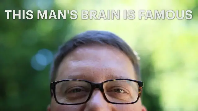 'Video thumbnail for Meet a man whose brain went viral before the Internet existed'