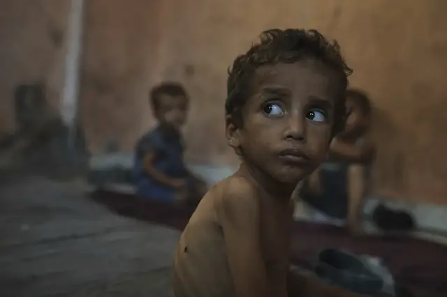 'Video thumbnail for Palestinian children wasting away: Israel’s aid blockade forces closure of soup kitchens'