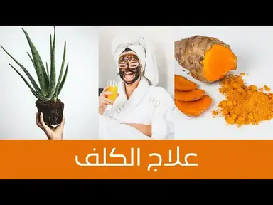 'Video thumbnail for How to Treat Melasma Naturally علاج الكلف بمكونات سهلة وطبيعية، ستلاحظين الفرق بعد اول استعمال'