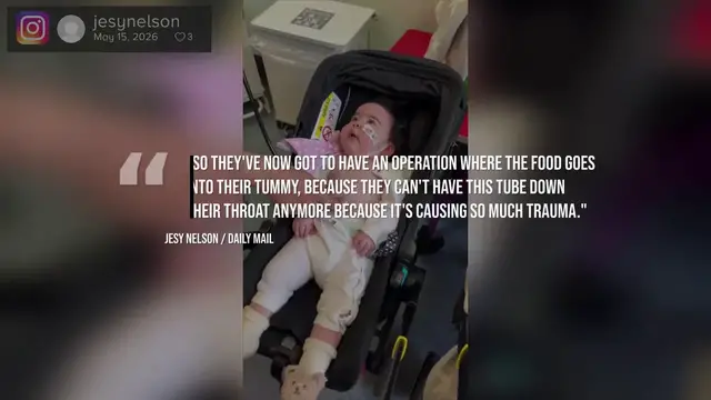 Video thumbnail for Jesy Nelson reveals daughter needs scoliosis surgery.