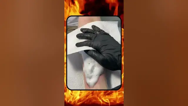 'Video thumbnail for Vasto Lorde Ichigo From Bleach Anime Tattoo Art | Scar Cover-Up Ideas | #Shorts'