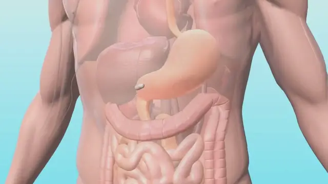 Video thumbnail for Was ist medizin