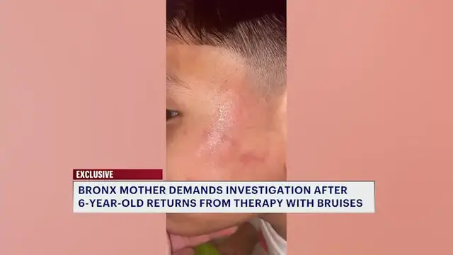 Video thumbnail for Bronx mother demands investigation after 6-year-old returns from therapy with bruises