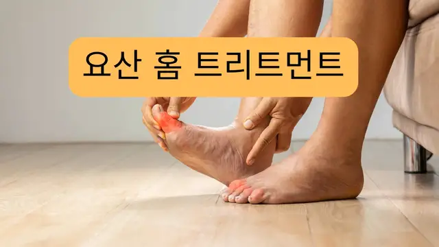 Video thumbnail for 요산 홈 트리트먼트