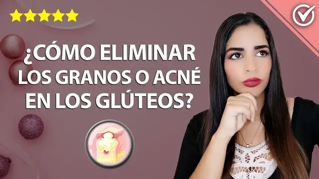Video thumbnail for Qué es la foliculitis en glúteos o ano, por qué aparece y cómo eliminarla 🧴