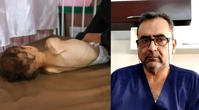 'Video thumbnail for Doctor describes challenges of treating acute malnutrition patients in Gaza'