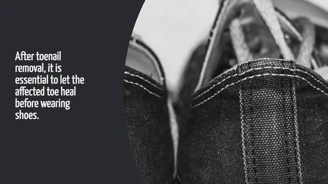 Video thumbnail for How Long After Toenail Removal Can I Wear Shoes