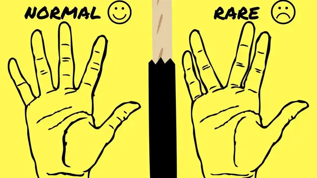 Video thumbnail for Space/Gaps Between The Fingers And Your Personality-Palmistry