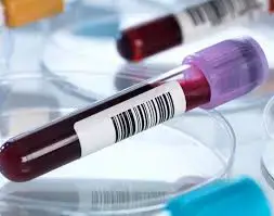 'Video thumbnail for What is CBC Test , FBC, CP | Normal Range, Clinical Significance'