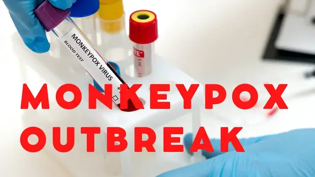 'Video thumbnail for 4th COVID Vaccine, Monkeypox, Mask-Optional Policy | How to Stay Safe?'
