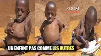 'Video thumbnail for ALPHONSE : UN ENFANT PAS COMME LES AUTRES : HISTOIRE CHOQUANTE 😭😭😭'