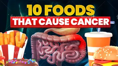 'Video thumbnail for 🚨 10 Foods That Cause CANCER'