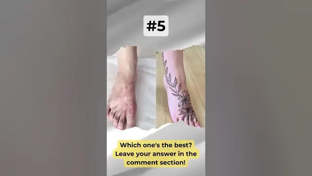 'Video thumbnail for 9 Awesome Scar Cover-Up Tattoo Ideas: You Can Only Choose One! | #Shorts'