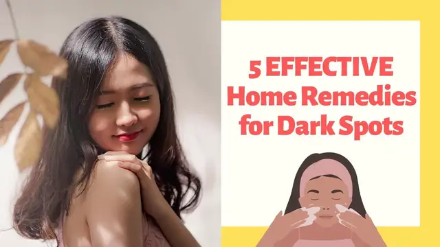 'Video thumbnail for 5 EFFECTIVE Home Remedies for Dark Spots That will Amaze You'