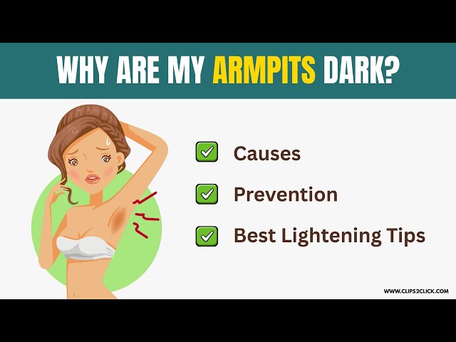 Video thumbnail for How to Get Rid of Dark Armpits Naturally | Causes, Prevention, and Best Lightening Tips