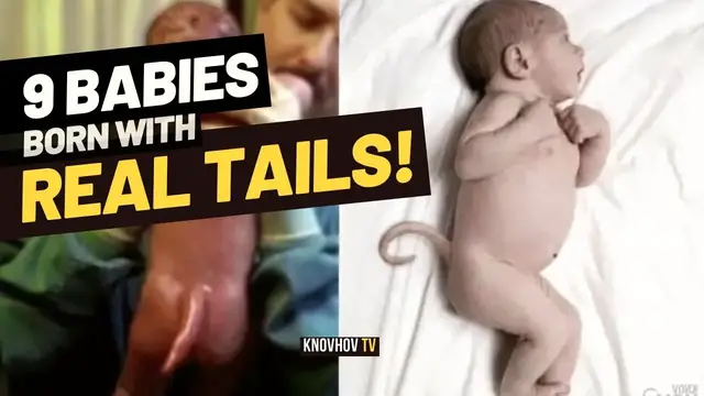 'Video thumbnail for 9 Babies Reported with Real Tails'