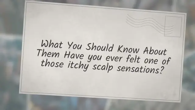 'Video thumbnail for The Biggest Head Lice ever found is'