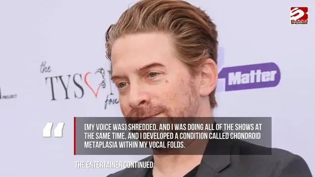 Video thumbnail for Seth Green "shredded" his vocal cords