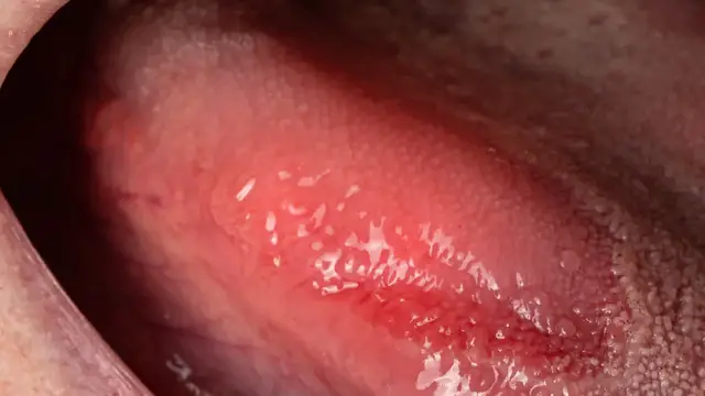 'Video thumbnail for The Silent Deficiency: Unraveling the Impact of Vitamin D Insufficiency'