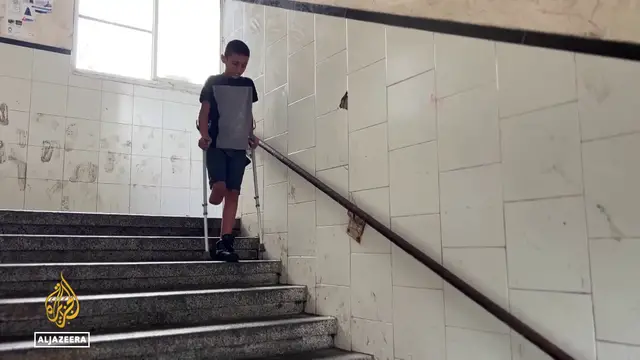 'Video thumbnail for Physical scars of war: health ministry reports 6,000 amputations'