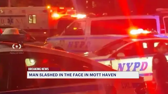 Video thumbnail for Man slashed in the face outside Mott Haven restaurant