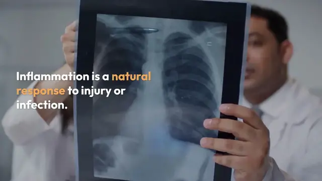 Video thumbnail for Natural Inflammation Relief Tips