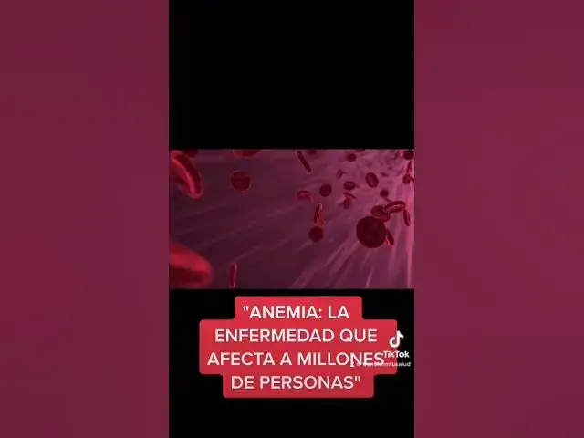 Video thumbnail for "ANEMIA: LA ENFERMEDAD QUE AFECTA A MILLONES DE PERSONAS"