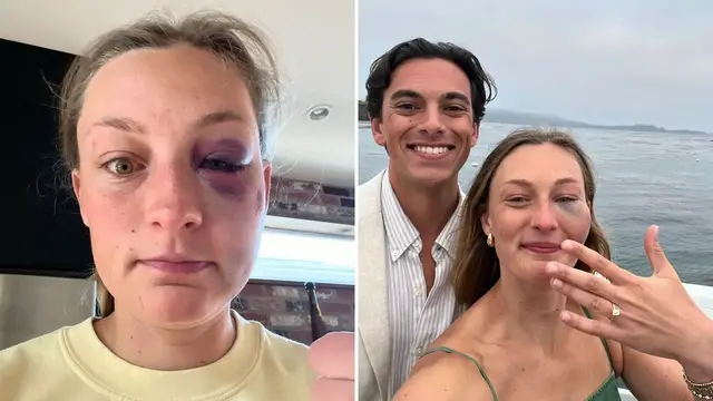Video thumbnail for Girlfriend Rocks Huge Black Eye For Proposal 'Like A Champ' After Getting Hit By Golf Ball